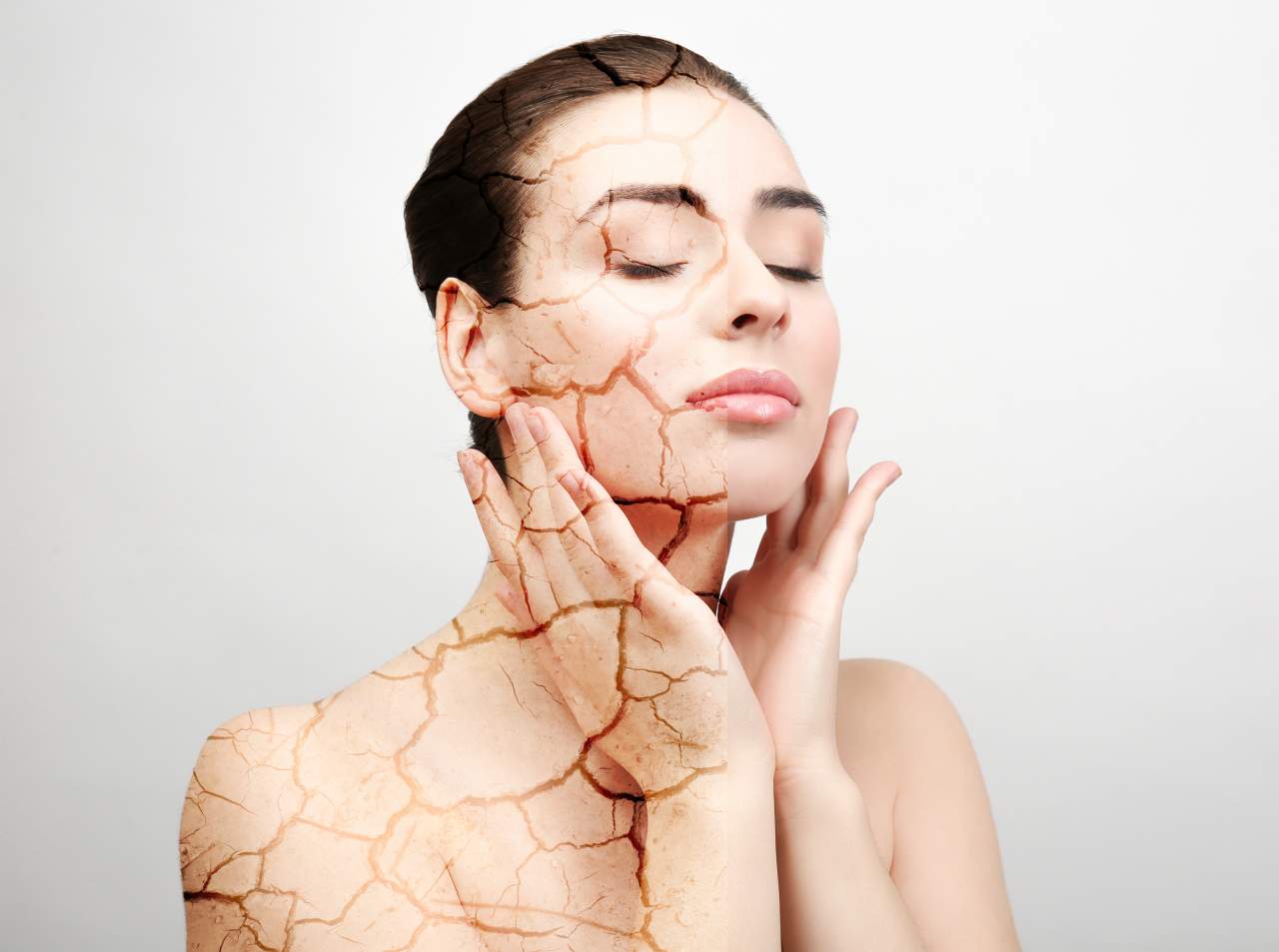 Rejuvenecer el rostro con microneedling: Montserrat Travé