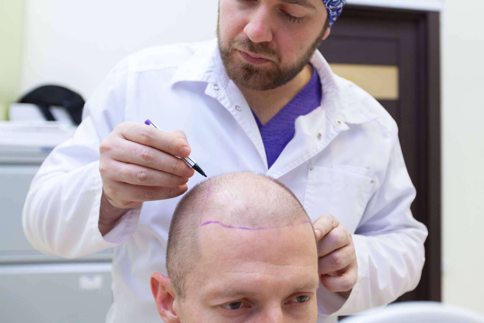 Fin a la caída de pelo hormonal o carencial con el tratamiento efectivo de Géomer