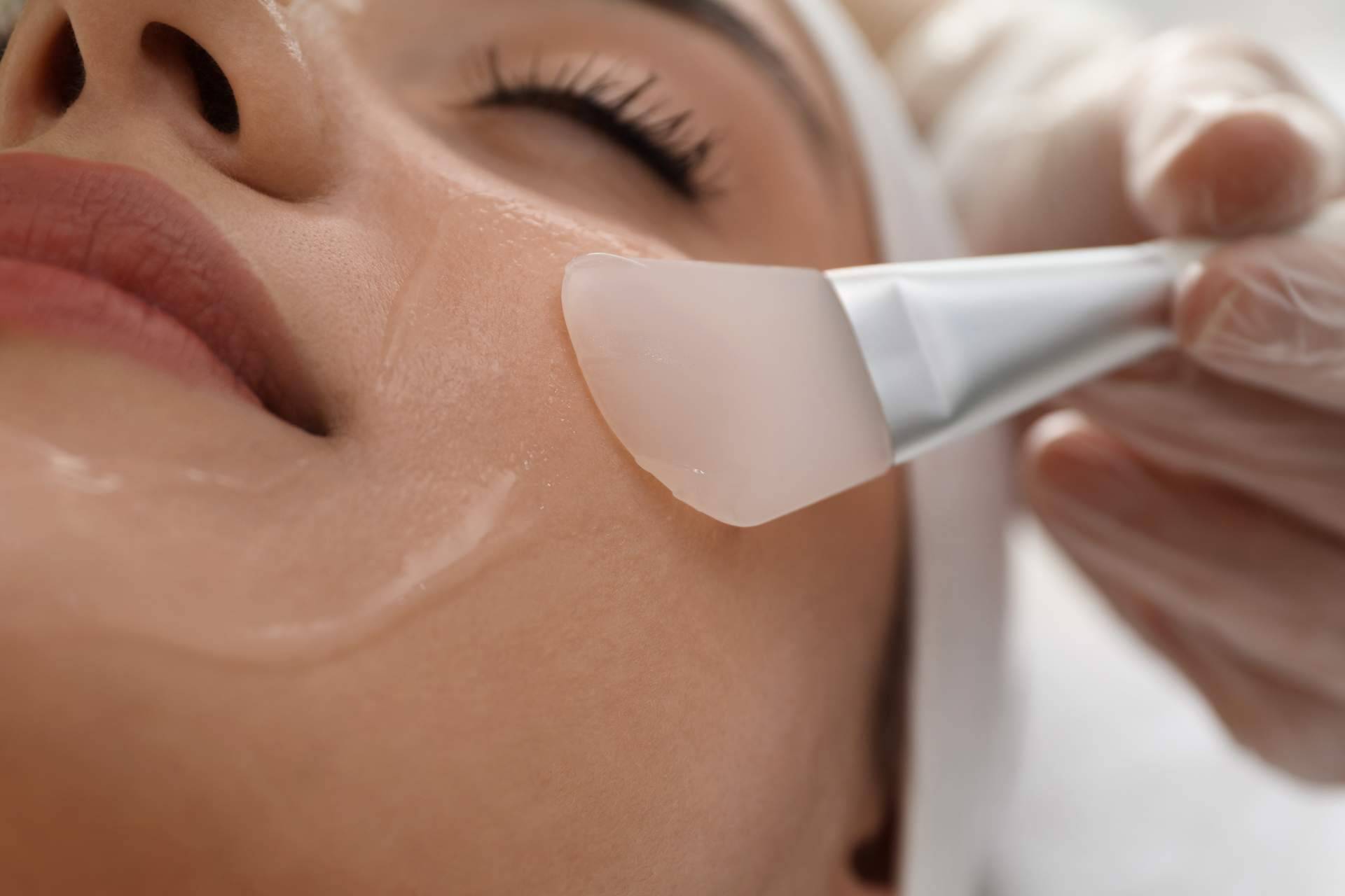 Los peeling químicos de Alluring Clinic funcionan como una herramienta para luchar contra el envejecimiento facial