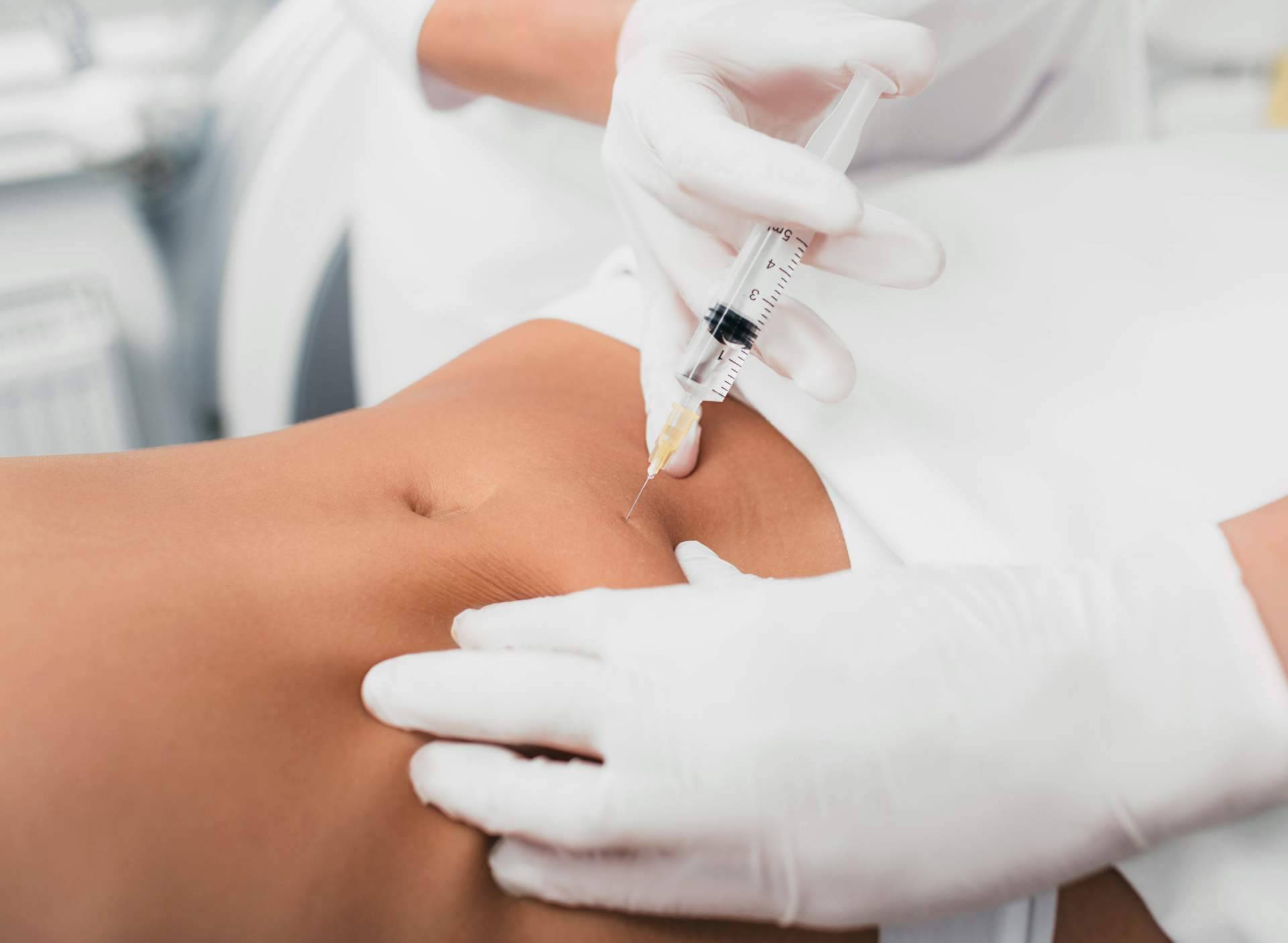 Alluring Clinic lleva a cavo mesoterapia efectiva contra la celulitis